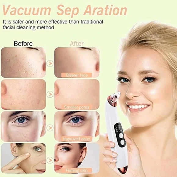 New Blackhead Remover Pore Vacuum Facial Deep Cleaner​ - Picture 5 of 7